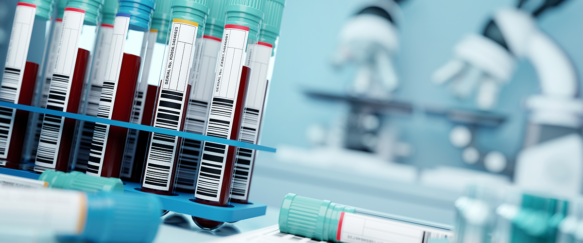 Blood samples in a laboratory.