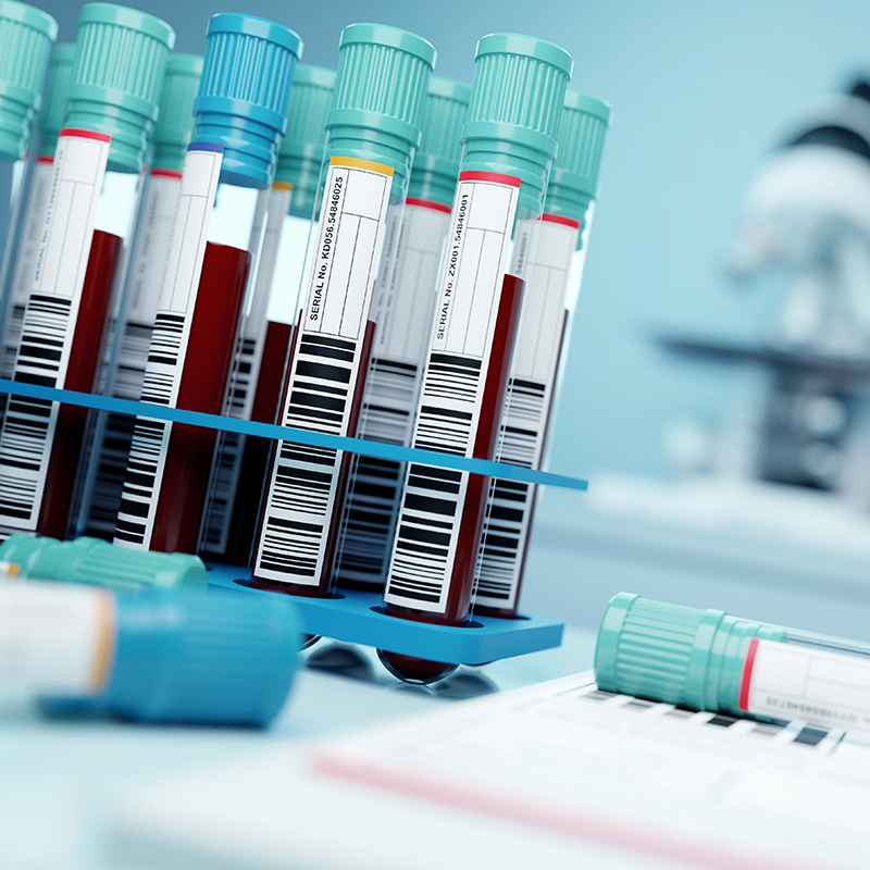 Blood samples in a lab.